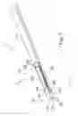 Fig. 04 - MULTI-FACETED NEEDLE TIP AND METHOD OF MANUFACTURING