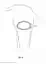 Fig. 12 - Colpotomy systems, devices, and methods with rotational cutting