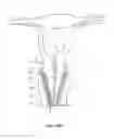 Fig. 14 - Colpotomy systems, devices, and methods with rotational cutting