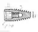 Fig. 02 - System, device and method for restoring the use of a damaged dental implant