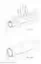 Fig. 02 - PROSTHESIS DELIVERY SYSTEM WITH RETENTION SLEEVE