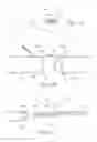 Fig. 08 - PROSTHESIS DELIVERY SYSTEM WITH RETENTION SLEEVE