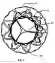 Fig. 07 - Method and Design for a Mitral Regurgitation Treatment Device