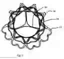 Fig. 08 - Method and Design for a Mitral Regurgitation Treatment Device