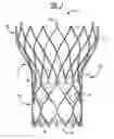 Fig. 02 - Transcatheter delivery system with wheel actuation