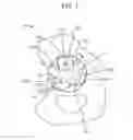 Fig. 02 - Augments and methods for implanting hip prostheses
