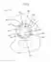 Fig. 07 - Augments and methods for implanting hip prostheses