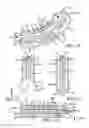 Fig. 07 - Sacroiliac joint fusion system
