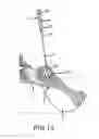 Fig. 08 - Sacroiliac joint fusion system