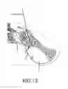 Fig. 09 - Sacroiliac joint fusion system
