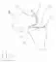 Fig. 09 - System and method for side insertion of a bicondylar mini knee implant