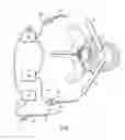 Fig. 02 - SYSTEMS AND METHODS FOR ENDOSCOPIC VERTEBRAL FUSION