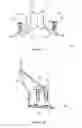 Fig. 02 - Total artificial spino-laminar prosthetic replacement