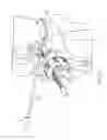 Fig. 22 - Meniscal transplant system