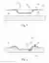 Fig. 02 - Convex shell for use in a base plate of an ostomy appliance