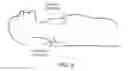 Fig. 07 - Method and apparatus for enhancement of chest compressions during CPR