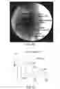 Fig. 49 - Unit doses, aerosols, kits, and methods for treating heart conditions by pulmonary administration
