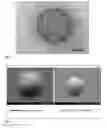 Fig. 02 - COATED BIOLOGICAL COMPOSITION