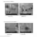 Fig. 16 - COMPOSITIONS COMPRISING ELECTROHYDRODYNAMICALLY OBTAINED FIBRES FOR ADMINISTRATION OF SPECIFIC DOSAGES OF AN ACTIVE SUBSTANCE TO SKIN OR MUCOSA