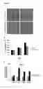Fig. 02 - Methods of treating liver fibrosis by administering 3-bromopyruvate