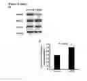Fig. 07 - Methods of treating liver fibrosis by administering 3-bromopyruvate