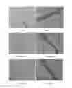 Fig. 02 - Use of Oligosaccharide Compounds for Activating Angiogenesis