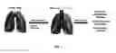 Fig. 02 - Organs for transplantation
