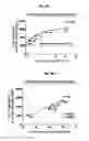 Fig. 09 - NK cells with an increased antibody-dependent cellular toxicity (ADCC) against tumors