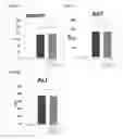 Fig. 06 - Prophylactic and/or therapeutic agent for NAFLD/NASH