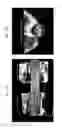 Fig. 22 - COMPOSITIONS AND METHODS FOR IMPROVING HEART FUNCTION AND TREATING HEART FAILURE