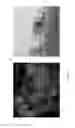 Fig. 23 - POLYMER-BASED THERAPEUTICS FOR INDUCTIVE BROWNING OF FAT
