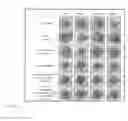 Fig. 11 - PROTEIN NANOSTRUCTURE BASED DRUG DELIVERY SYSTEM FOR THE DELIVERY OF THERAPEUTIC AGENTS TO THE ANTERIOR SEGMENT OF THE EYE