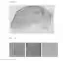 Fig. 02 - Composition for preventing or treating keloid or hypertrophic scars