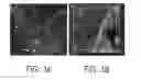 Fig. 08 - SYSTEMS, METHODS, AND COMPOSITIONS FOR IMAGING ANDROGEN RECEPTOR AXIS ACTIVITY IN CARCINOMA, AND RELATED THERAPEUTIC COMPOSITIONS AND METHODS