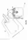 Fig. 32 - NEGATIVE PRESSURE WOUND THERAPY APPARATUS AND METHODS