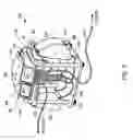 Fig. 06 - On demand dialysate mixing using concentrates