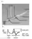 Fig. 03 - Computer controlled pediatric regional anesthesia