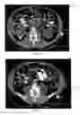 Fig. 08 - Parenteral nutrition diagnostic system, apparatus, and method