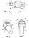 Fig. 16 - Low radial profile needle safety device
