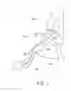 Fig. 02 - ENDOTRACHEAL CLEANING SUCTION BRUSH