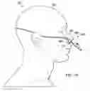 Fig. 06 - Flexible endoscopic peripheral