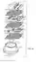 Fig. 34 - Ground electrical path from an MLCC filter capacitor on an AIMD circuit board to the ferrule of a hermetic feedthrough
