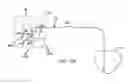 Fig. 79 - Ground electrical path from an MLCC filter capacitor on an AIMD circuit board to the ferrule of a hermetic feedthrough