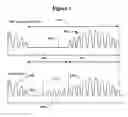 Fig. 02 - Detecting and treating disordered breathing