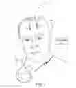 Fig. 02 - Brain stimulation therapy