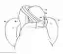 Fig. 01 - AVALANCHE PROTECTION DEVICE