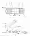 Fig. 02 - Foam exercising roller