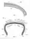 Fig. 07 - TIRE WITH PRE-STRESSED TOROIDAL ELEMENT
