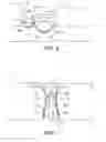 Fig. 04 - REDUCING WEAR IN HITCH APPARATUSES