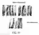 Fig. 07 - Compositions and methods to prevent cancer by stabilizing p53 through non MDM2-mediated pathways